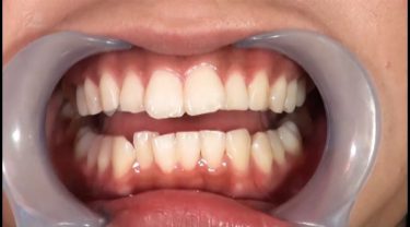 フェチ選！！口腔淫診大パノラマショー